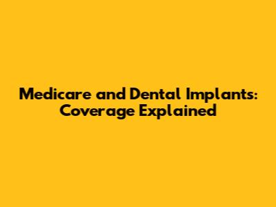Medicare and Dental Implants: Coverage Explained