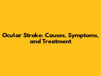 Ocular Stroke: Causes, Symptoms, and Treatment