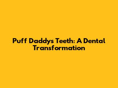 Puff Daddy's Teeth: A Dental Transformation